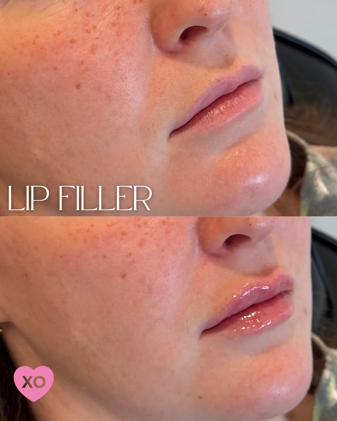 BEFOREAFTER - 12