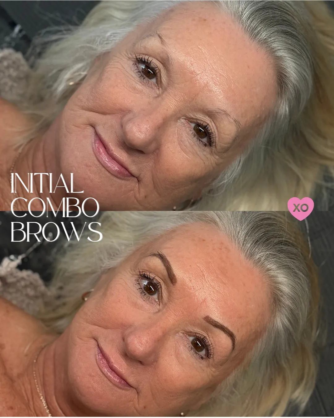 BEFOREAFTER - 14