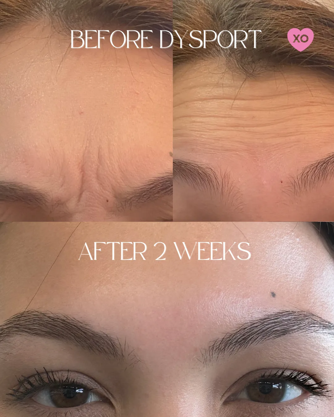 BEFOREAFTER - 18