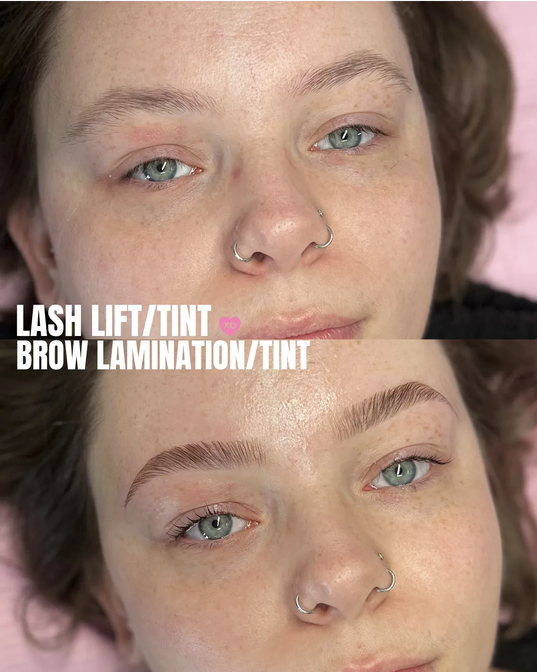 BEFOREAFTER - 29