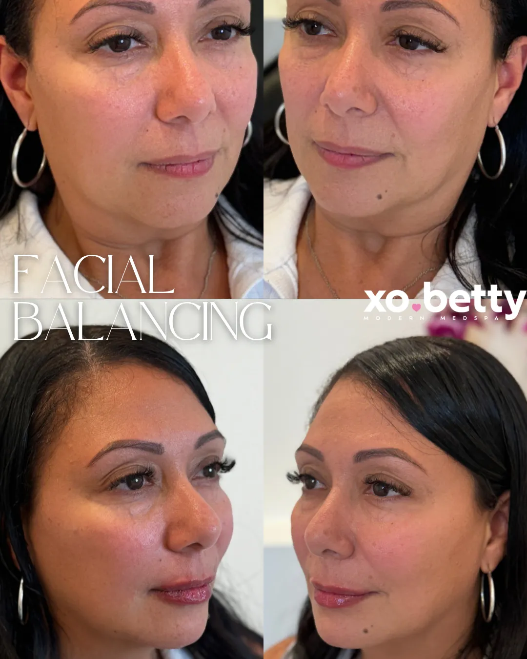 BEFOREAFTER - 3