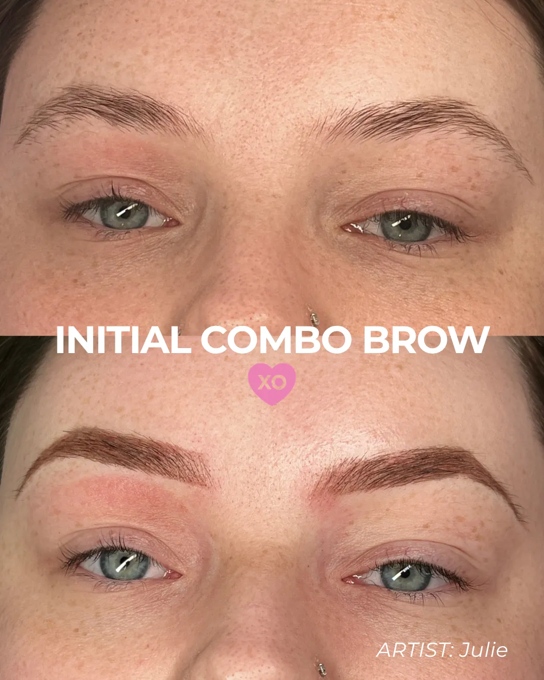 BEFOREAFTER - 39