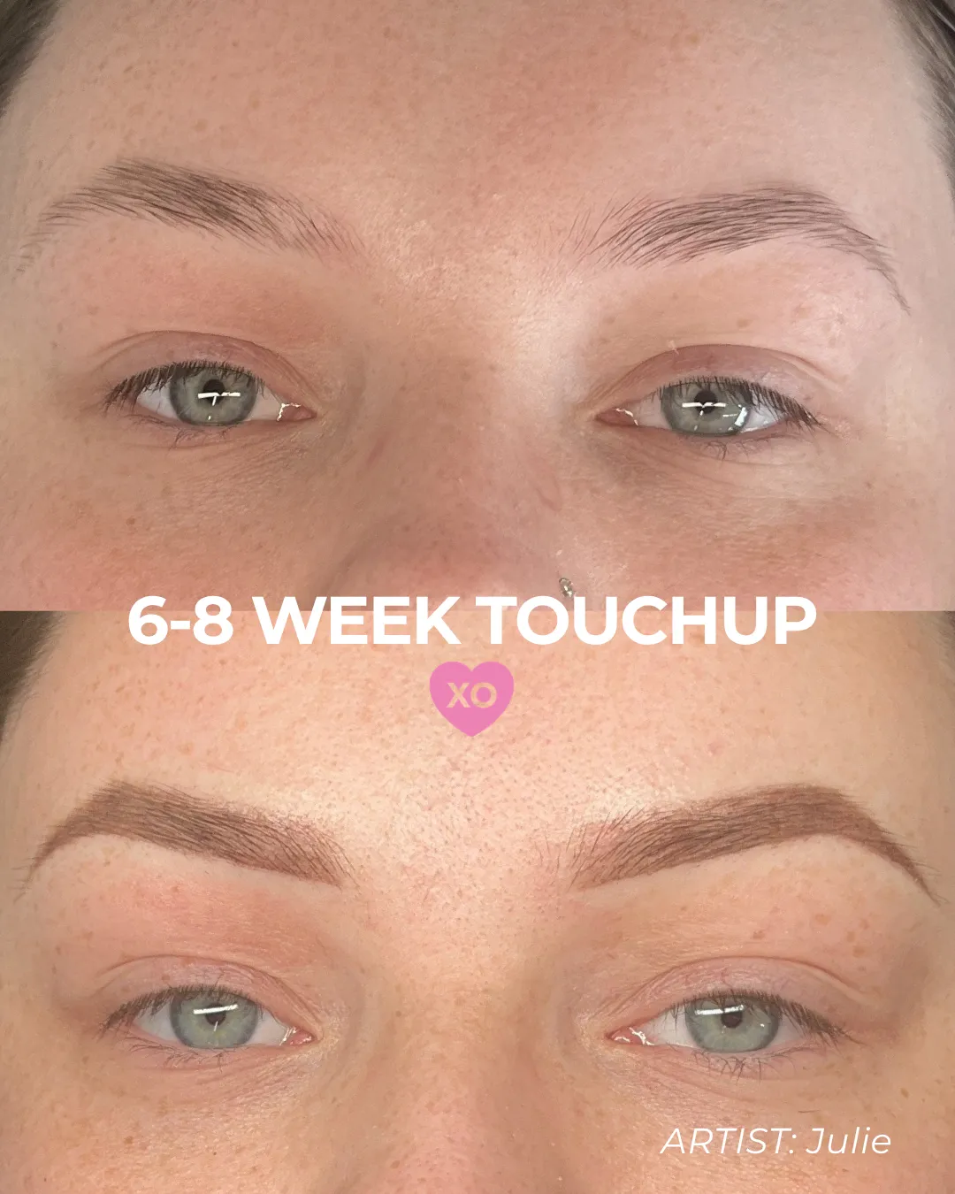 BEFOREAFTER - 40