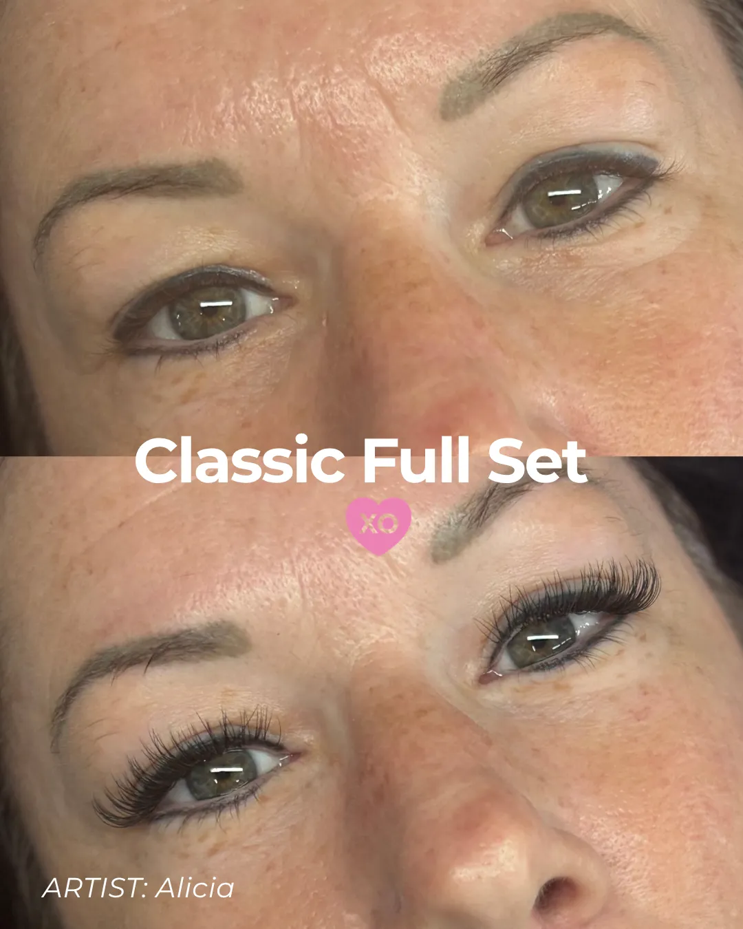 BEFOREAFTER - 46