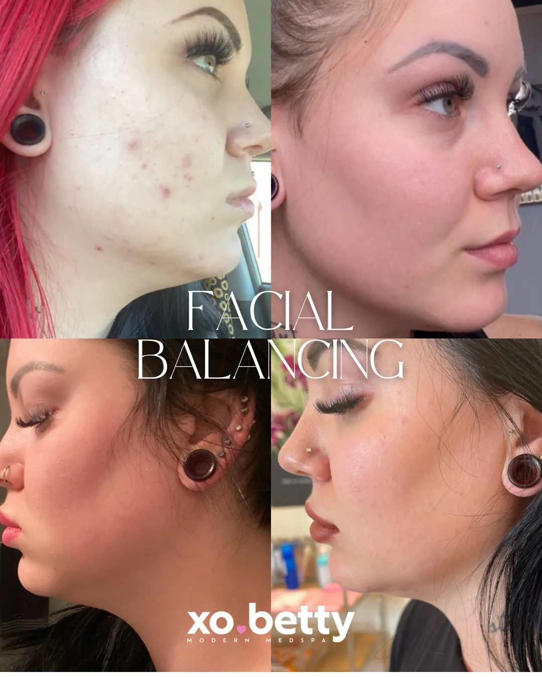 BEFOREAFTER - 6