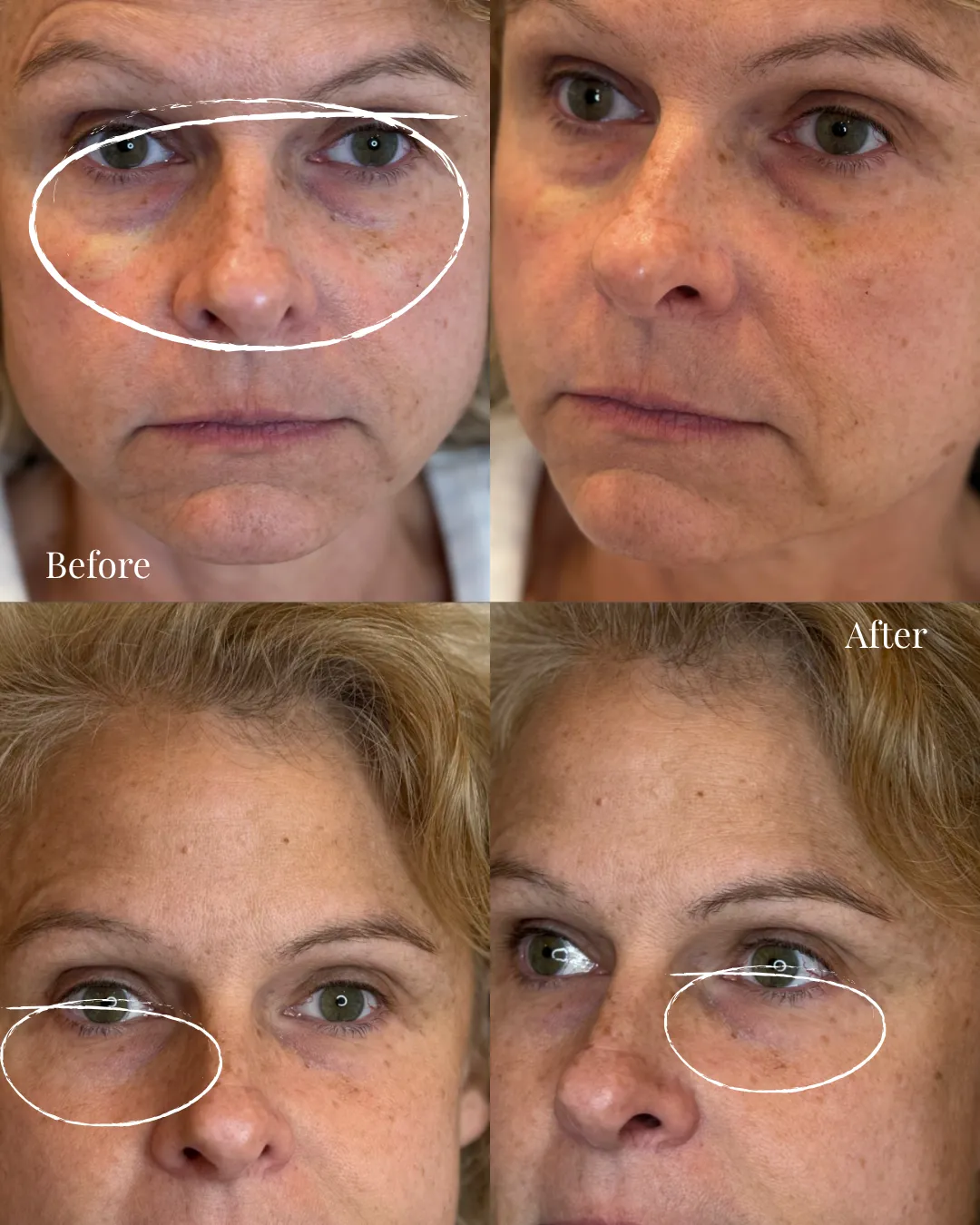 BEFOREAFTER - 9
